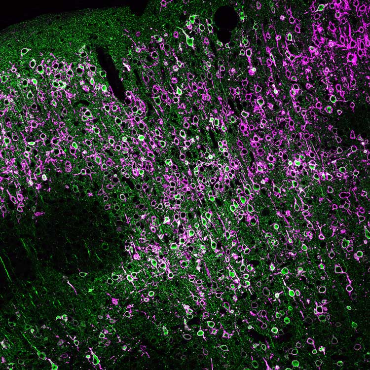 Bolton Lab soma targeted channelrhodopsin